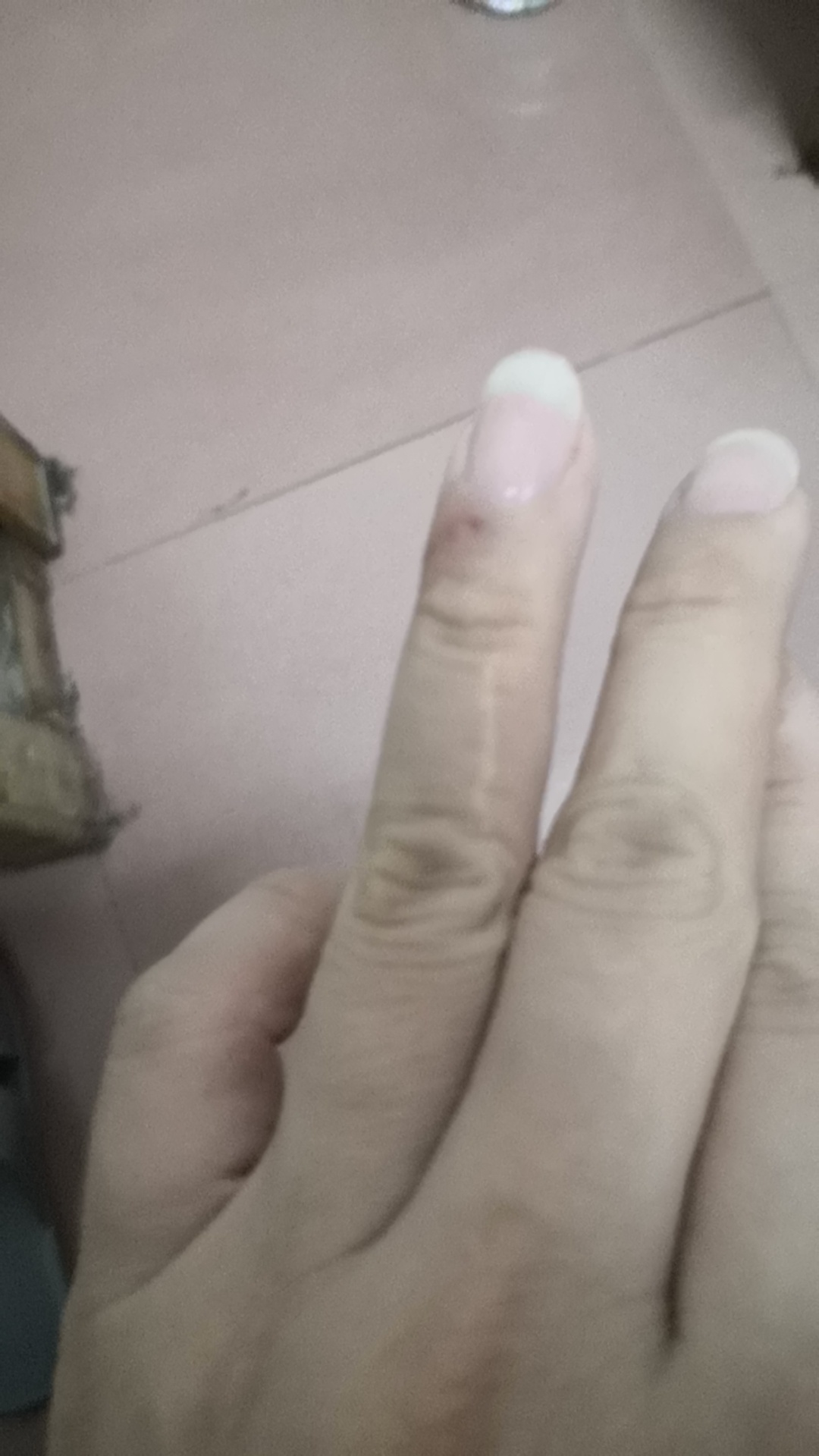 每个人或多或少都有疤痕，你身上的疤痕有什么故事呢？690 / 作者:猛龙 / 帖子ID:285784