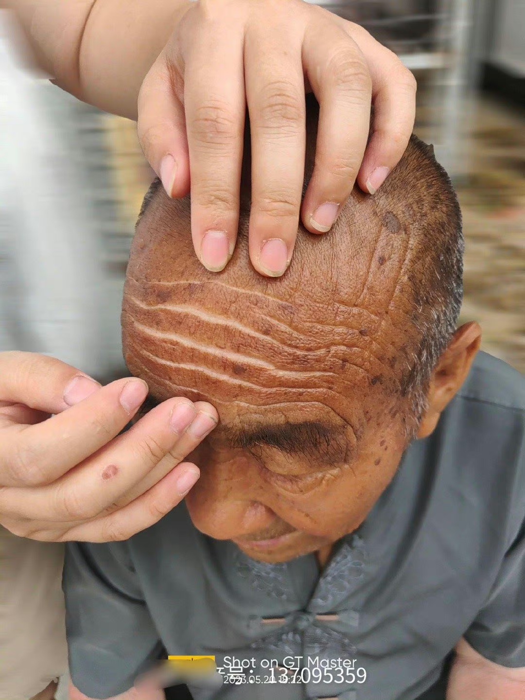 事实证明晒不到的地方真的不会黑10 / 作者:Miss.晴栀 / 帖子ID:306940