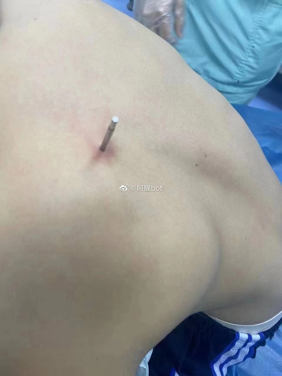 未成年下手真狠，螺丝刀直接插到底161 / 作者:猛龙 / 帖子ID:307172