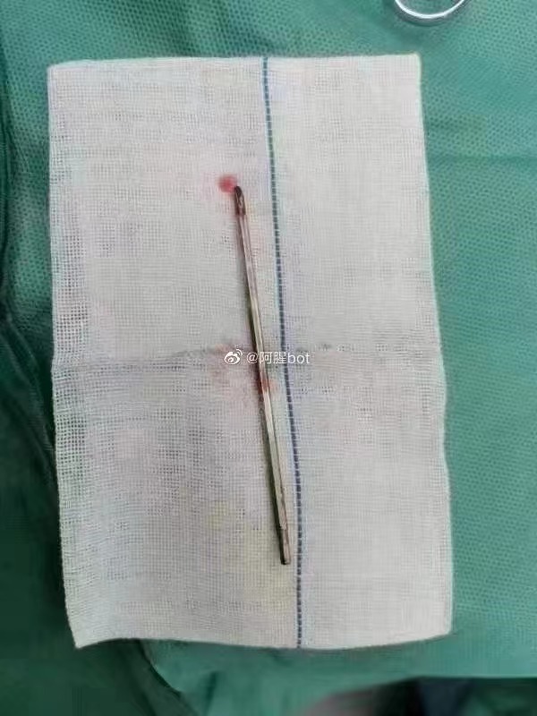 未成年下手真狠，螺丝刀直接插到底887 / 作者:猛龙 / 帖子ID:307172