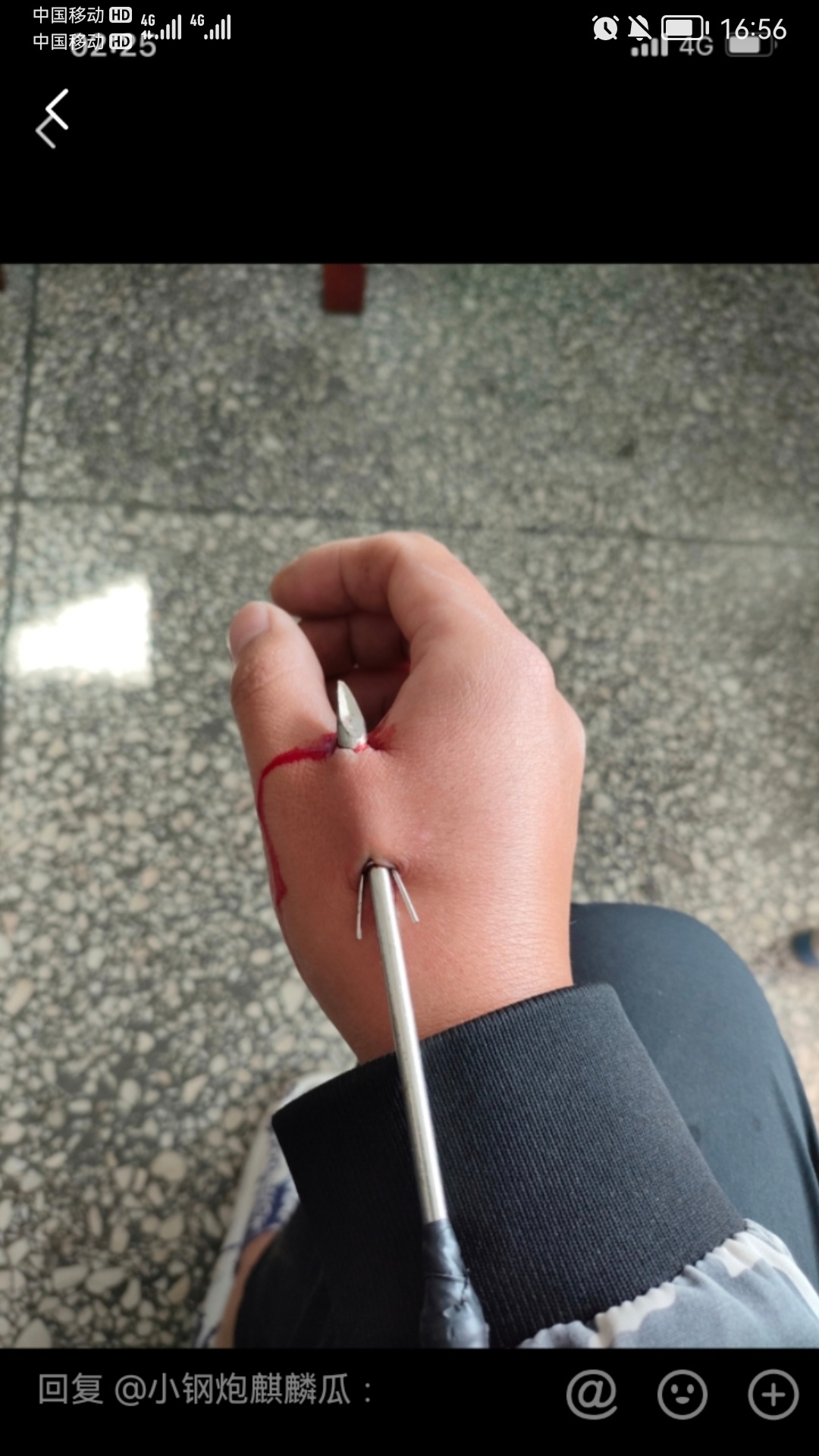 拿弹弓射鱼失手后的结果830 / 作者:猛龙 / 帖子ID:307704