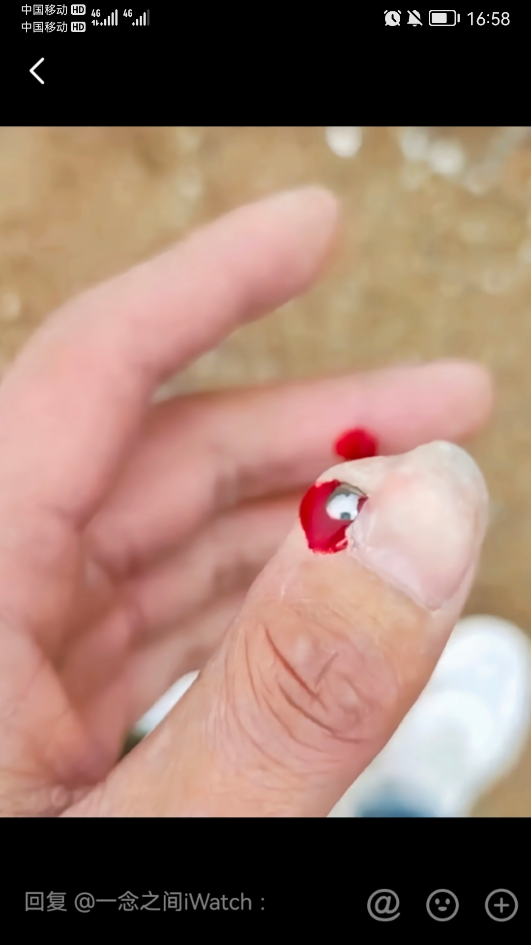 拿弹弓射鱼失手后的结果340 / 作者:猛龙 / 帖子ID:307704