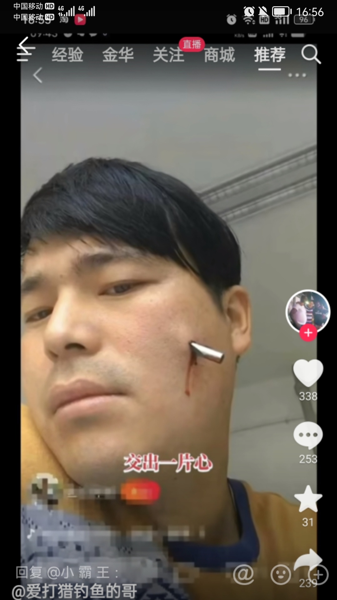 拿弹弓射鱼失手后的结果936 / 作者:猛龙 / 帖子ID:307704