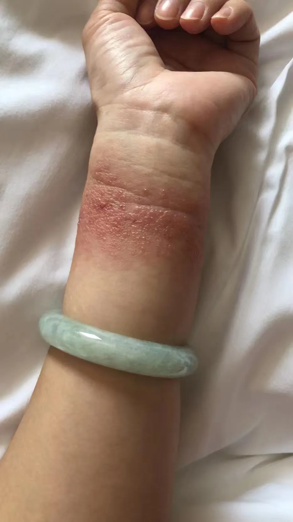 这个是用铀235做的吧（药水浸泡染色的）335 / 作者:猛龙 / 帖子ID:309873