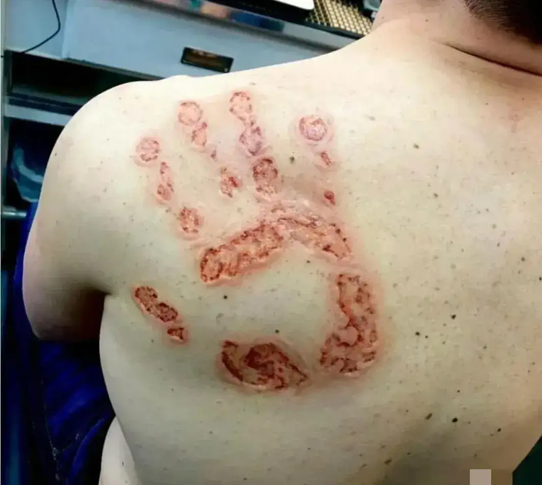 这个是什么掌打的？769 / 作者:猛龙 / 帖子ID:310088