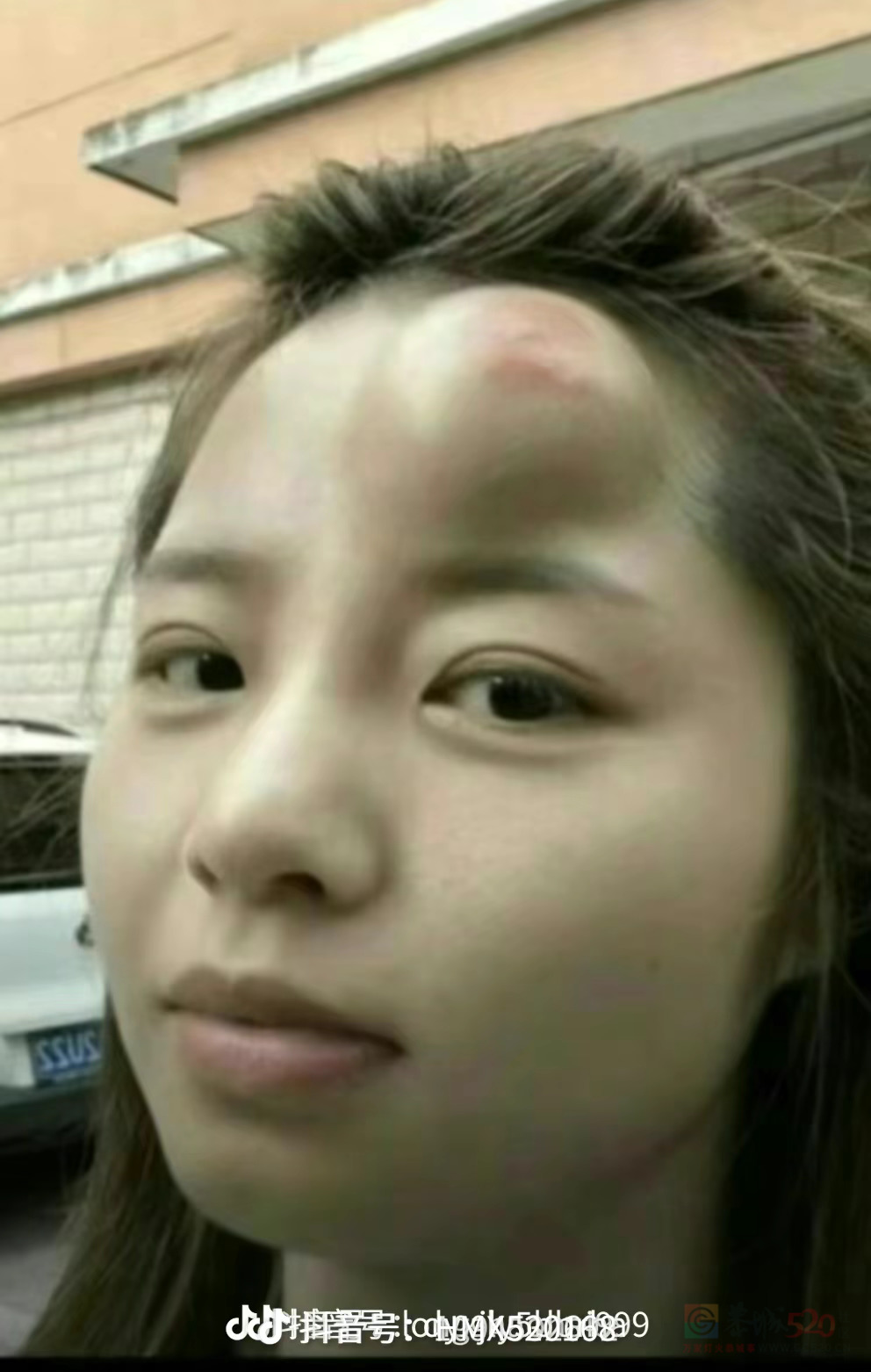 劫后余生，太可怕了635 / 作者:猛龙 / 帖子ID:314894