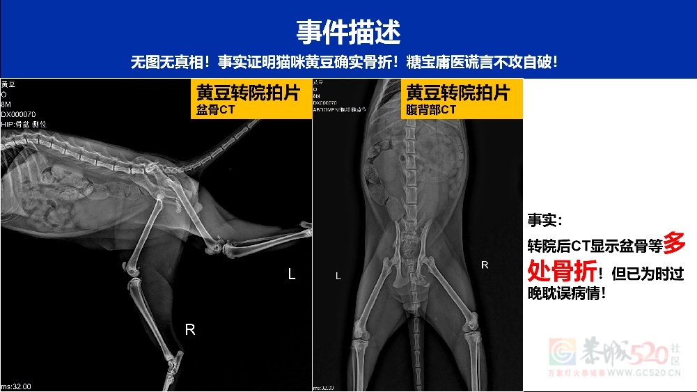 【避雷帖】！气到手抖！腹部手术治坠楼，这医院是屠宰场吧？！466 / 作者:NEARGO / 帖子ID:319071