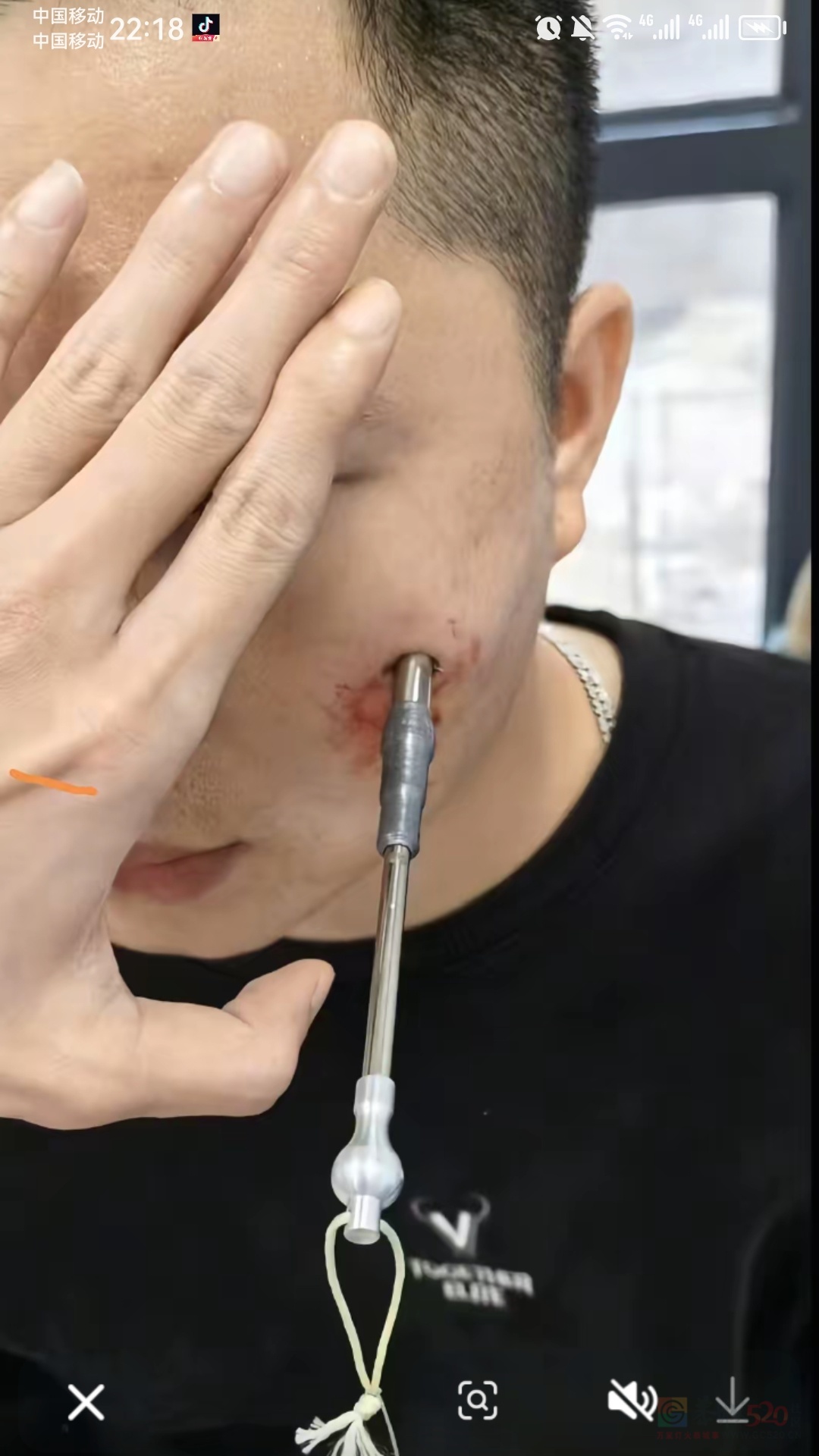 射鱼的时候开心！报应来的时候射中自己就爽了928 / 作者:猛龙 / 帖子ID:319470